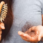 آلوپسی آره آتا چیست و آیا درمان قطعی دارد؟